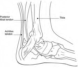 Ankle Showing the Achilles Tendon